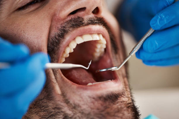 Best Dentist for Dental Trauma  in Macon, MS