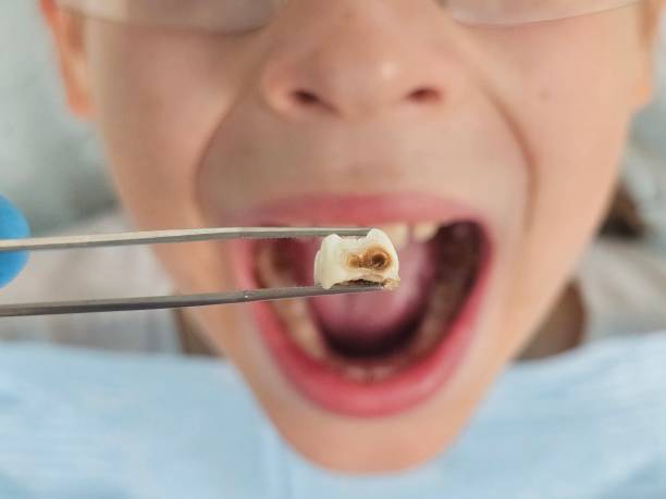 Best Emergency Pediatric Dentist  in Macon, MS